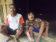 Keterbelakangan Mental Remaja 22…